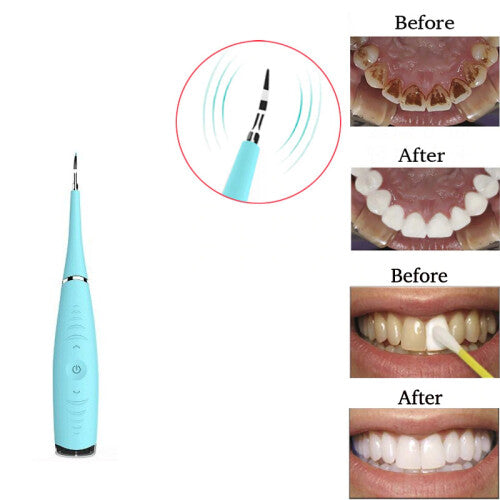 Dental Scaler